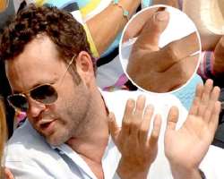 Vaughn once met an accident in which he lost a piece of his thumb.